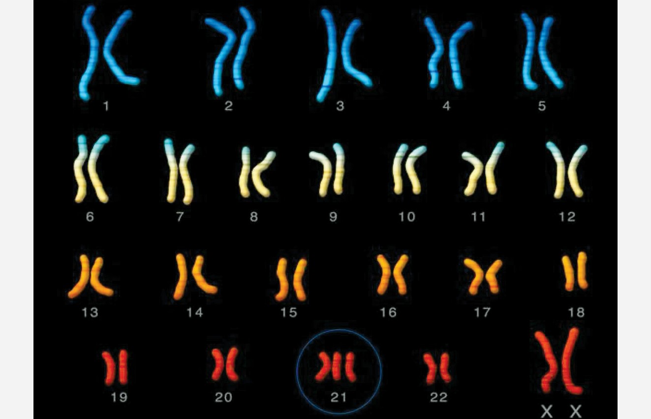 Together against loneliness