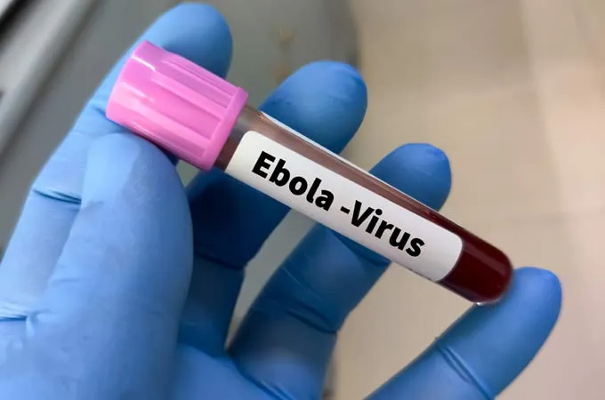 Africa CDC takes steps to prevent spread of ebola virus